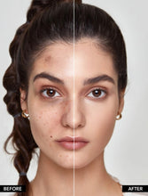 Load image into Gallery viewer, SHEGLAM Multi-Fix Concealer And Color Corrector-6-Color Full Cover Cream Concealer Brightening Full Coverage Color Corrector Lightweight Multi-Use Smooth Concealer