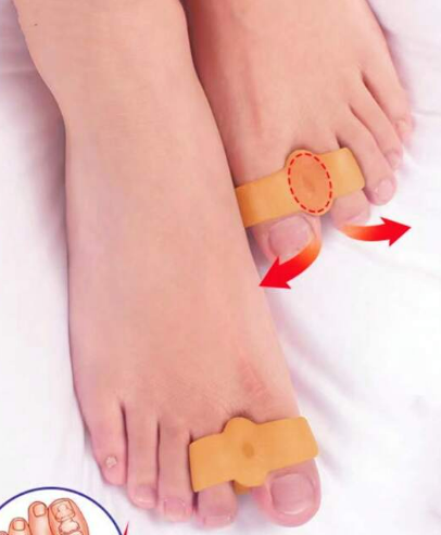 2pcs TPE Toe Protector