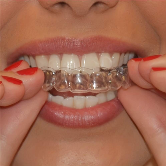 2 قطع طب الأسنان حماية طقم : طحن الأسنان و , يحافظ على شفوي صحيح و نوم